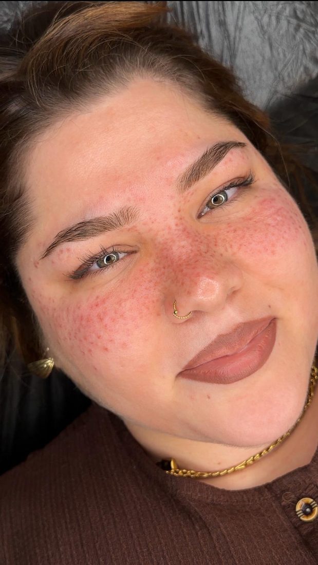 PMU-Freckles direkt nach der Behandlung – frisch gesetzt