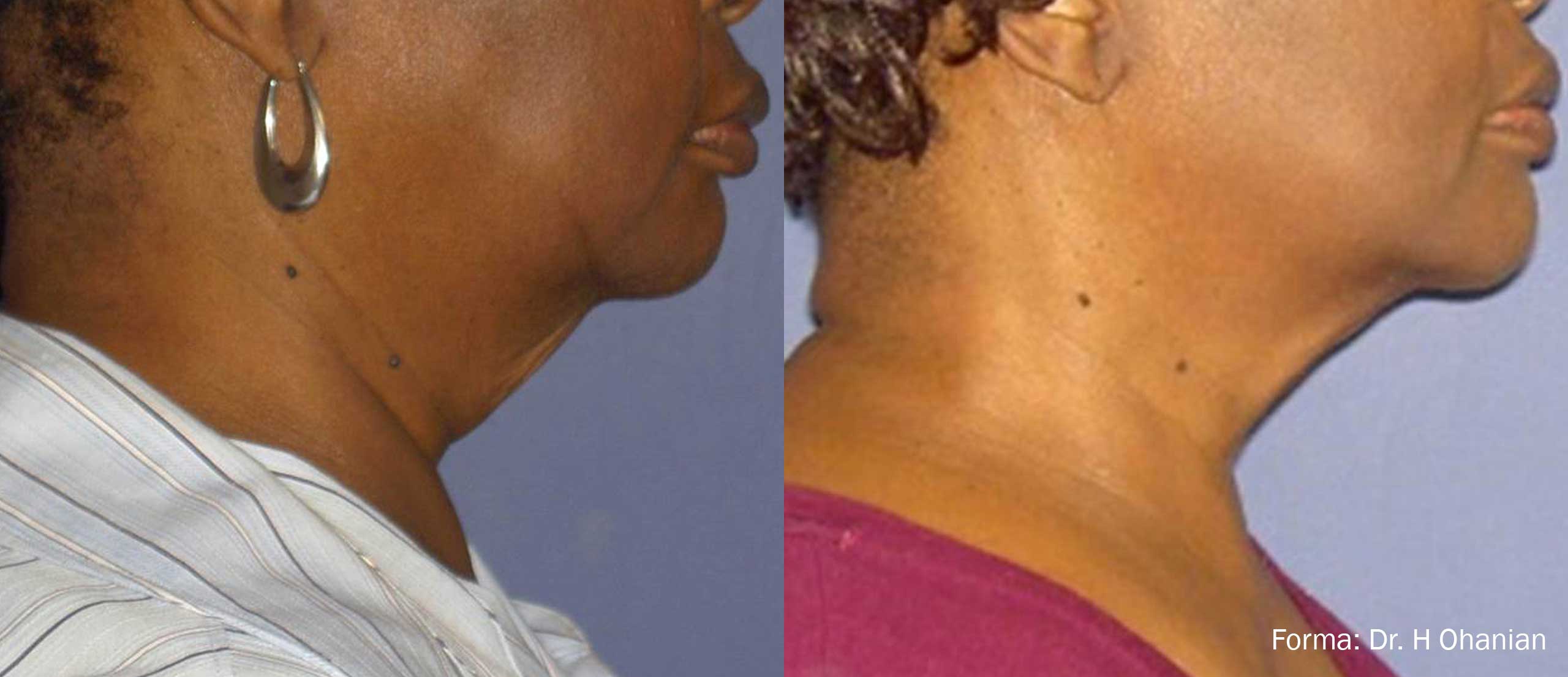 BODY FX bei Geestglanz