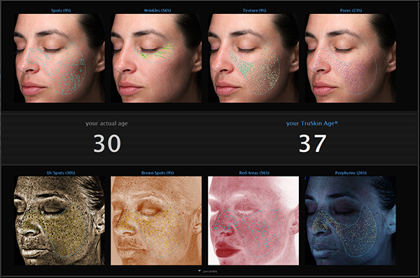 VISIA Auswertung: Pigment, Poren, Rötungen, UV-Schäden und TruSkin-Age